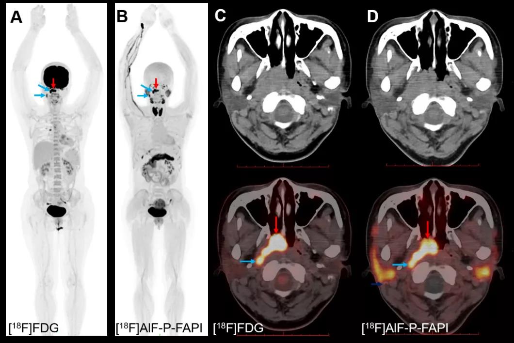 1636598848201962.jpg 1636598848201962.jpg
